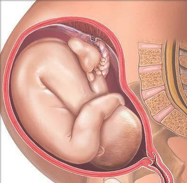 剖腹产后多久可以怀孕(剖腹产1年3个月怀孕)