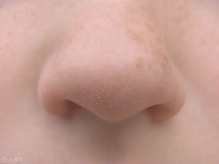 鼻子脱皮（鼻子双侧容易出现红肿脱皮