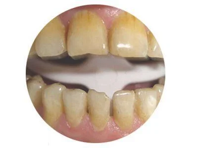 牙黄变白的方法（牙齿发黄是什么原因