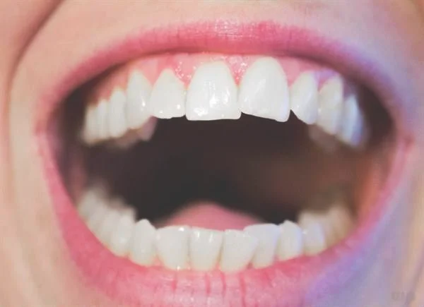 缓解牙疼的8个简单方法（快速缓解牙齿痛的小妙招和牙痛的注意事项）