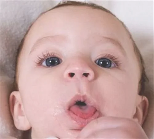 了解宝宝百日咳的症状和治疗方法